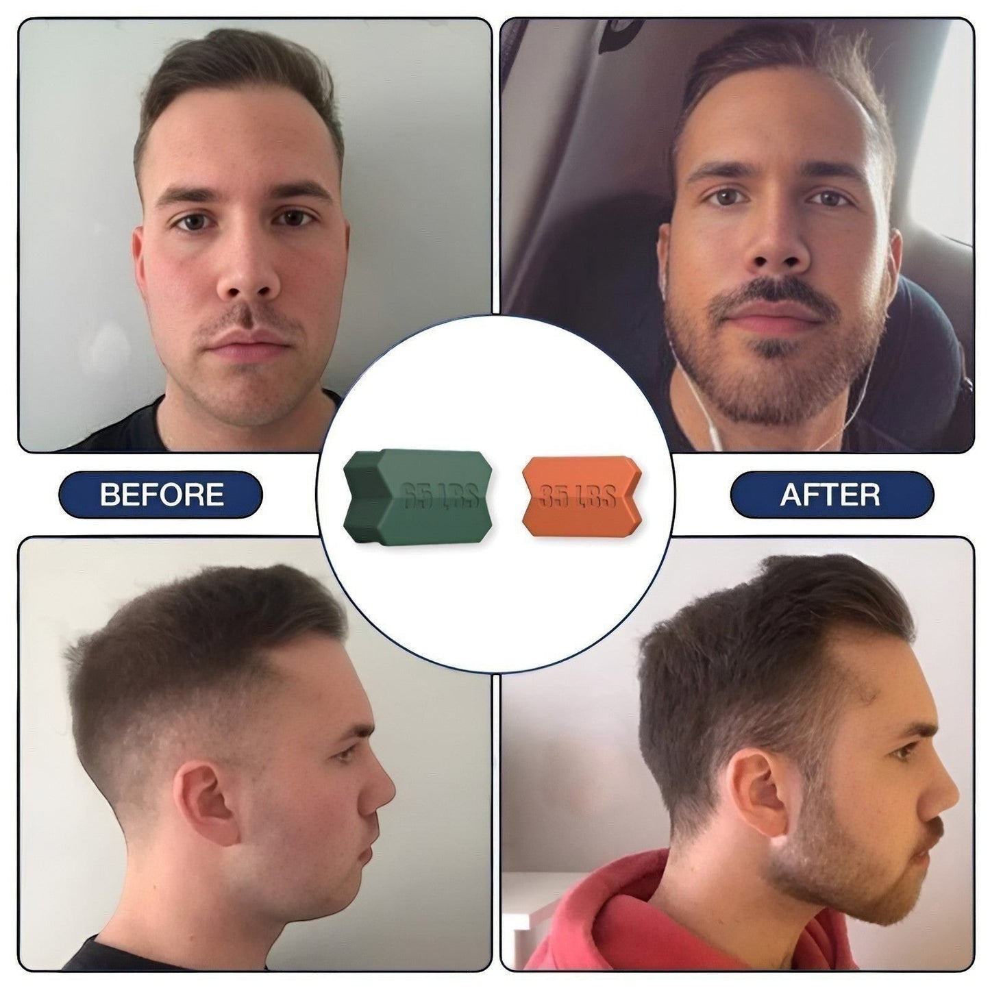 Dropset™ Official JawFlex jaw exerciser before and after comparison showing improved jawline definition. Green and orange exercisers shown.